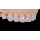 KODENT - KOKALJ IN DRUŽBENIK IZDELAVA IN PRODAJA VOŠČENIH TER LESENIH IZDELKOV IN DRUGE STORITVE, K.D.