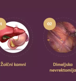 kirurgija za žolčne kamne 