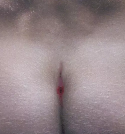 ambulanta za urologijo