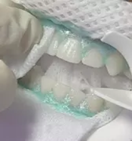Zasebna zobna ambulanta rogaska slatina