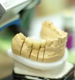 kakovostna zobna protetika dolenjska