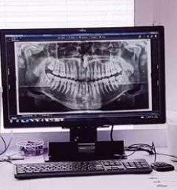 Zobni rentgen celje