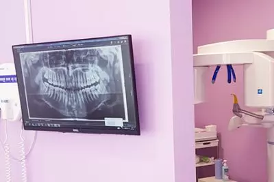 Kje v Celju lahko opravim zobni rentgen?