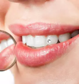 Zobozdravnik maribor