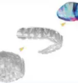 Zobozdravstvene storitve in ustna higiena ljubljana