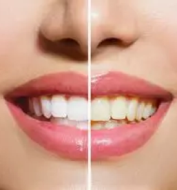 Zobozdravstvo brezice