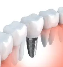 Zobozdravstvo Brežice, Slovenija