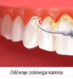 Zobozdravstvo stajerska
