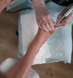 Medicinska pedikura gorenjska vas