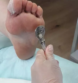 Medicinska pedikura gorenjska vas