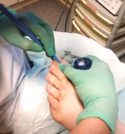 Medicinska pedikura gorenjska vas