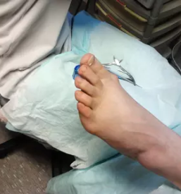 Ugodna medicinska pedkura ljubljana