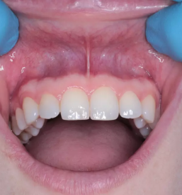 Ustna higiena ljubljana okolica