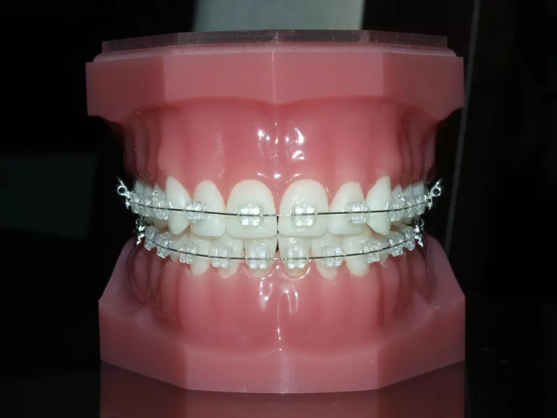 Dobra ortodontija Murska Sobota