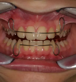 Ortodont murska sobota