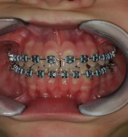 Ortodont za odrasle Murska Sobota