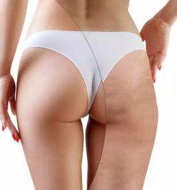 Kozmeticni salon celje