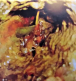 Ciscenje kanalizacij ljubljana okolica