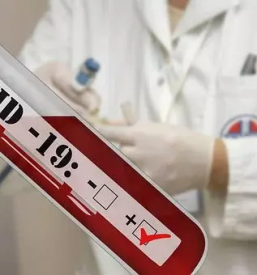 Hitri antigenski test maribor