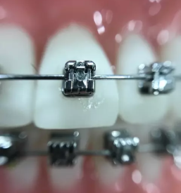 Ortodont na koncesijo krsko