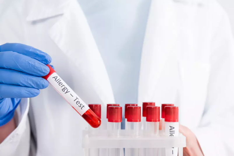 Alergološka testiranja Pomurska