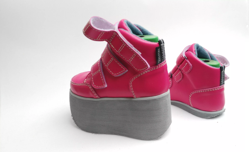 Ortopedski vložki za različne nepravilnosti stopal