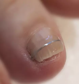 Dobra pedikerka velenje