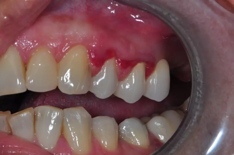 Najboljši zobozdravnik v Domžalah