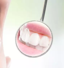 Kvaliltetno beljenje zob Ljubljana