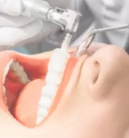 Zdravljenje zob