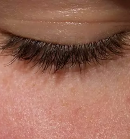Lash lift terapija