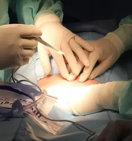 Kirurški center žil