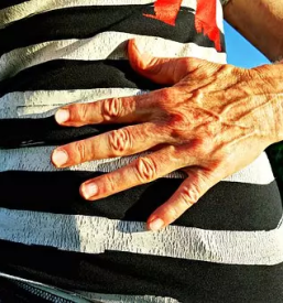 Kirurški center krvnih žil slovenija