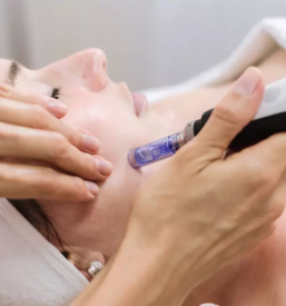 Ugoden microneedling mezoterapija maribor