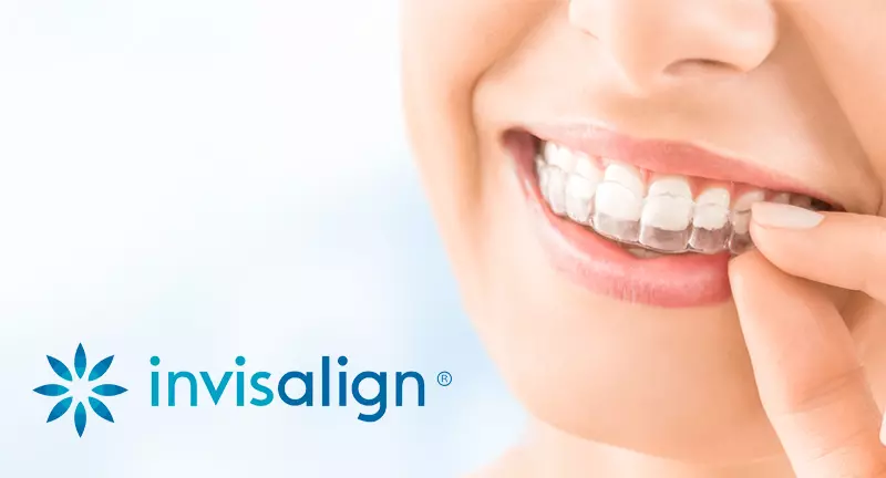 Neviden zobni aparat invisalign Ljubljana