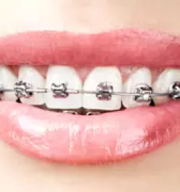 Ortodont ljubljana okolica