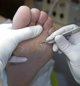 Klasicna in medicinska pedikura maribor