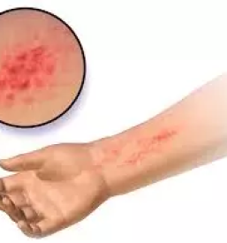 Kakovostna bioresonanca Vrhnika