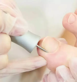 Medicinska pedikura ljubljana siska