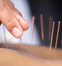 Ugodna akupunktura ljubljana