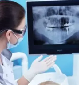 Strojno sirjenje koreninskih kanalov ljubljana