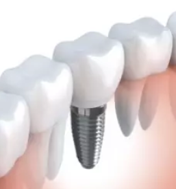 Kvalitetna izdelava implantatov osrednja slovenija