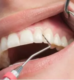 Kvalitetna izdelava implantatov osrednja slovenija