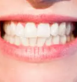 Ortodont kranj