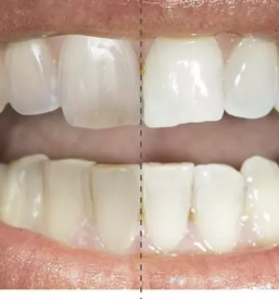 Samoplacniske zobozdravstvene storitve gorenjska