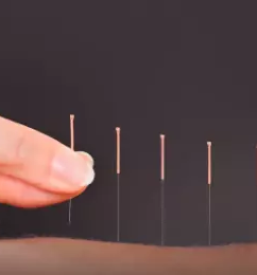 Kvalitetna akupunktura koroska