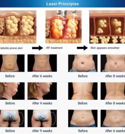 Uv lifting obraza maribor okolica