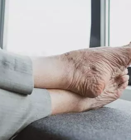 Ugodna pedikura Brežice