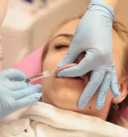 Aplikacija kolagena hialurona botoksa ljubljana siska