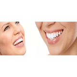 JAGODA STREHOVEC - ZASEBNA ZOBOZDRAVSTVENA ORDINACIJA